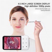 ENT Borescope Visual Ear Spoon 3.9mm Lens 4.5 Inch 1080P HD Screen Food-Grade Silicone High Precision 200W Endoscope for Safe Comfortable Ear Cleaning